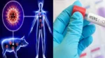 Swine Flu: बढ़ रहे H1N1 के मामले, कहीं आप भी तो नहीं हैं हाई रिस्क ग्रुप में? जानिए खतरे के संकेत